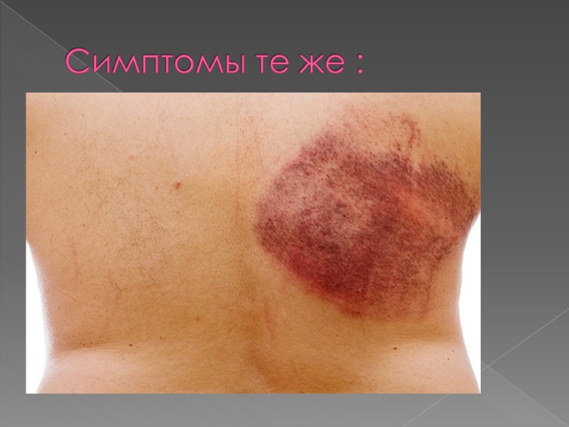 Симптомы те же :